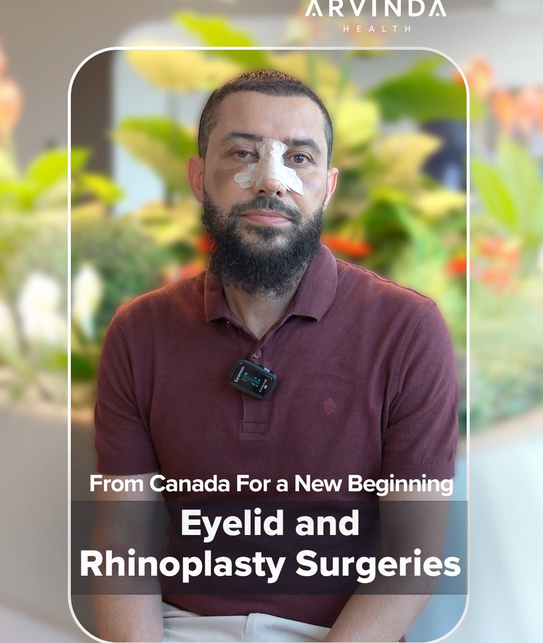https://arvindahealth.net/wp-content/uploads/2026/07/Arvinda-Rhinoplasty-1081x1280.jpg